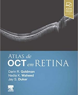 Atlas De Oct Em Retina