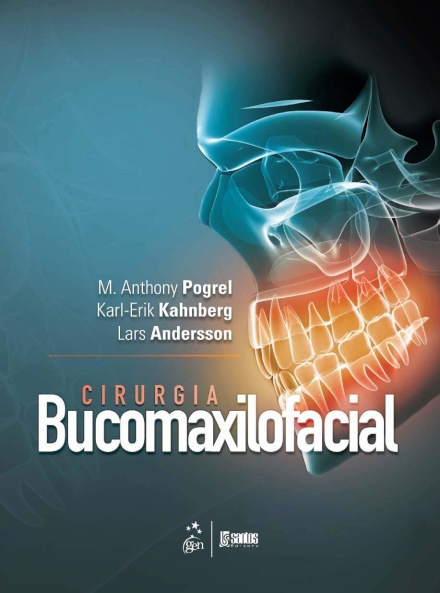 Cirurgia Bucomaxilofacial