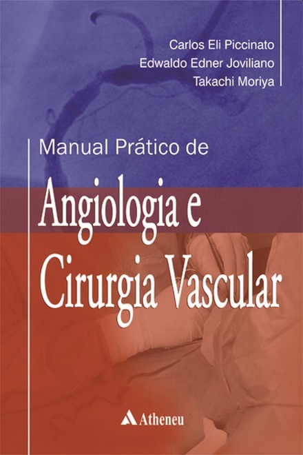 Manual Prático de Angiologia e Cirurgia Vascular