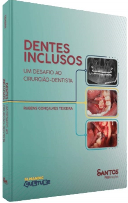 Dentes Inclusos: Um Desafio Ao Cirurgião-Dentista