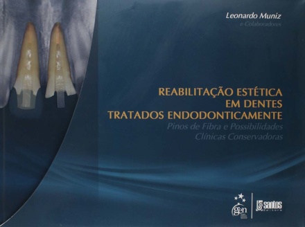 Reabilitação Estética Dentes Tratados Endodonticamente - Pinos de Fibra Possibilidades Clínicas Conservadoras