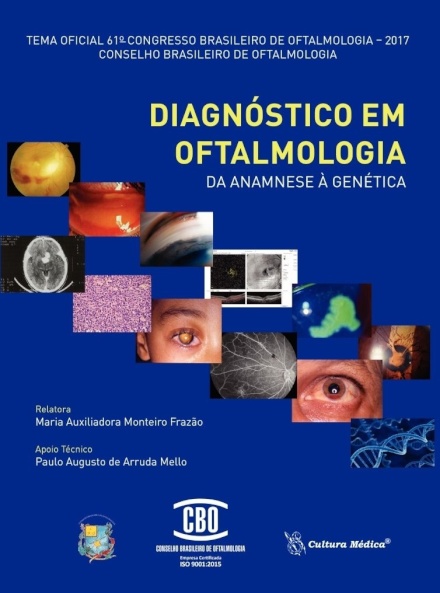 Diagnostico em Oftalmologia da Anamnese a Genetica