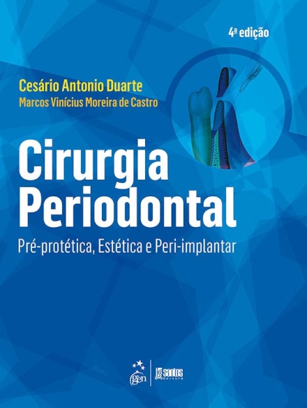 Cirurgia Periodontal Pré-Protética Estética Peri-implantar